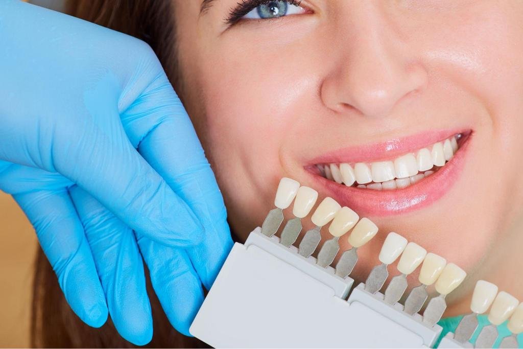 Esthétique Dentaire Tanger – Sélection de teinte pour blanchiment et facettes dentaires lors d’un soin esthétique du sourire.