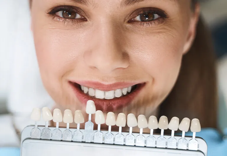 Facette Dentaire Tanger – Patiente comparant les teintes dentaires avant un traitement de facettes dentaires esthétiques.