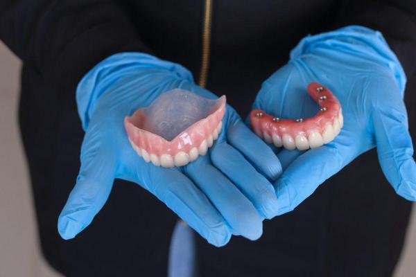 Présentation de prothèses dentaires complètes amovibles et fixes sur implants utilisées pour la réhabilitation du sourire et le remplacement des dents.