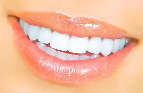 Sourire esthétique après traitement chez un dentiste à proximité et restauration dentaire moderne