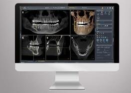Logiciel de radiographie dentaire numérique affichant plusieurs vues panoramiques et scanners 3D des dents sur écran d’ordinateur en cabinet dentaire.