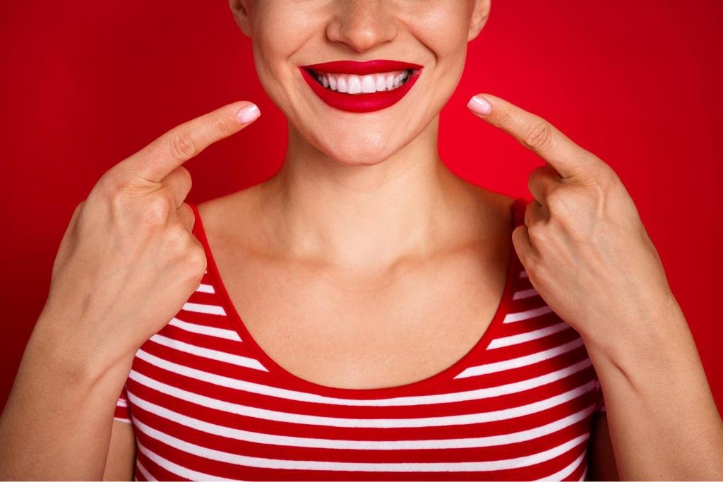 Gros plan sur un sourire Hollywood Smile avec dents blanches et alignées, mettant en valeur des facettes dentaires esthétiques et un sourire lumineux.