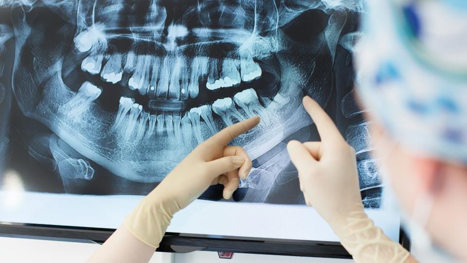 Dentiste analysant une radiographie panoramique dentaire avec sa patiente