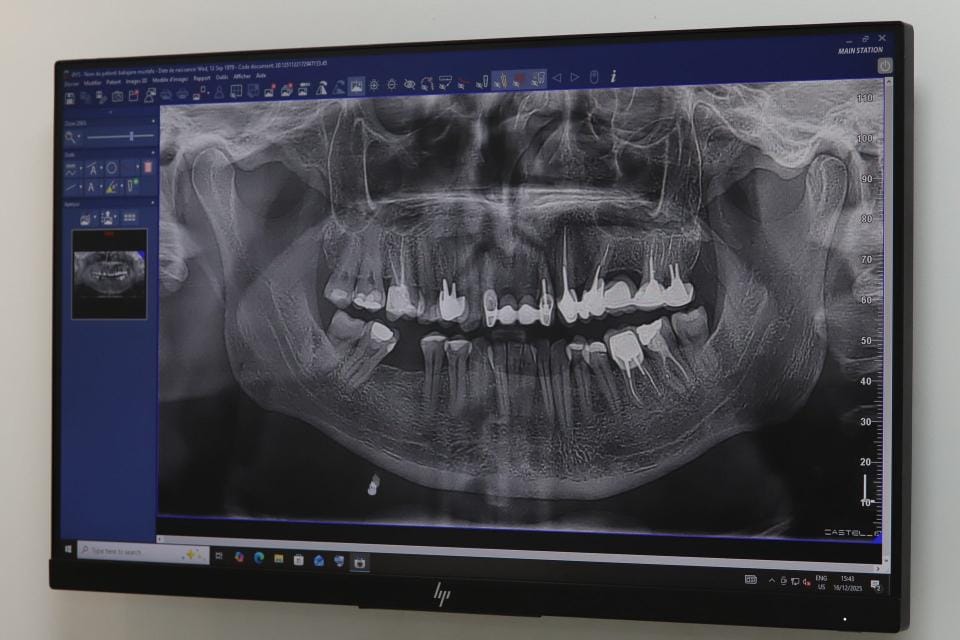 Radio panoramique dentaire réalisée à Tanger au Divina Dental Center